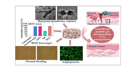  Yttrium Oxide Nanoparticles: Revolutionizing Bone Tissue Engineering and Dental Implants!